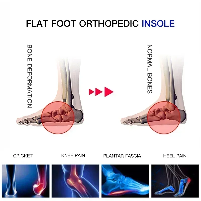 Professionele boogondersteunen - Cycling Shoe Insoles recensie en prijs